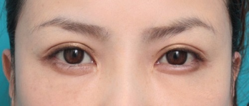 o0800034111011389783-650x277